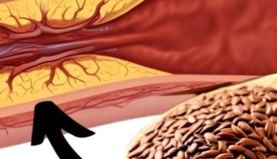 1 Tablespoon a Day: Flaxseed to Prevent Blood Clots, Heart Attacks, and Strokes!